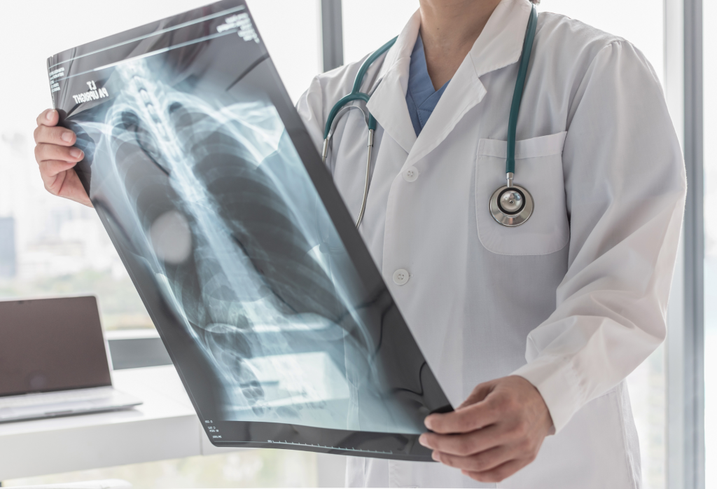 Dr. looking at an Xray.